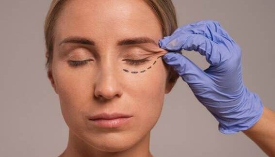 Blepharoplastik Chirurgen in München